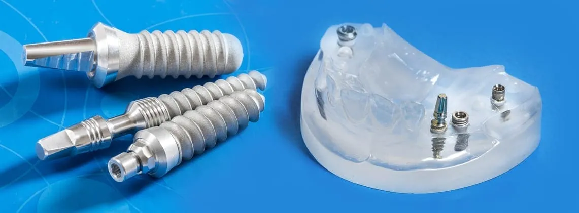 Implant zęba. Implanty zębów. Uzupełnienie braków zębowych.
